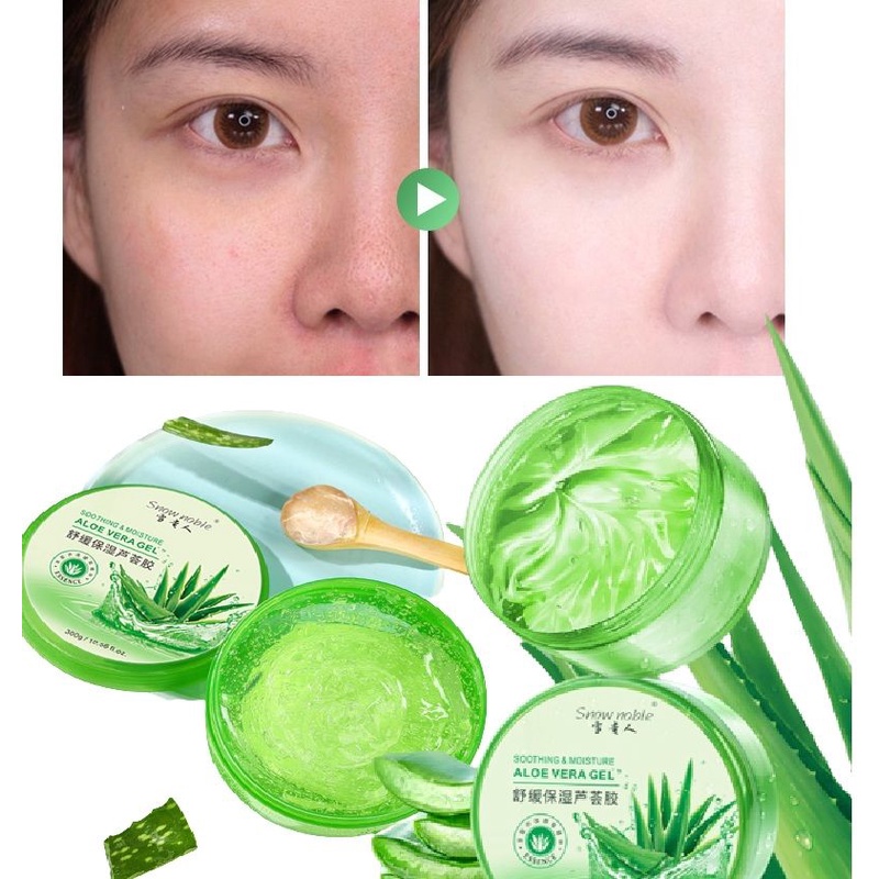 Gel Nha Đam Dạng Tuýp