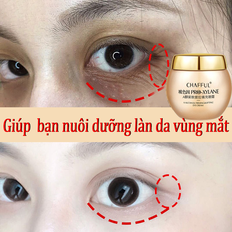 Kem Dưỡng Mắt Chống Lão Hóa