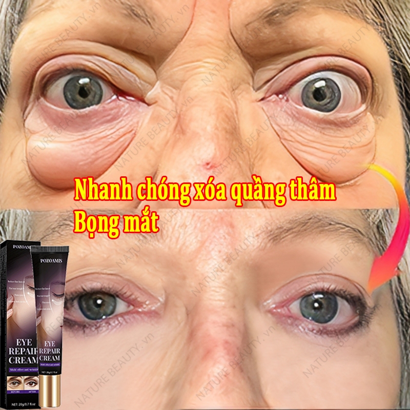Kem Mắt Giảm Thâm Quầng