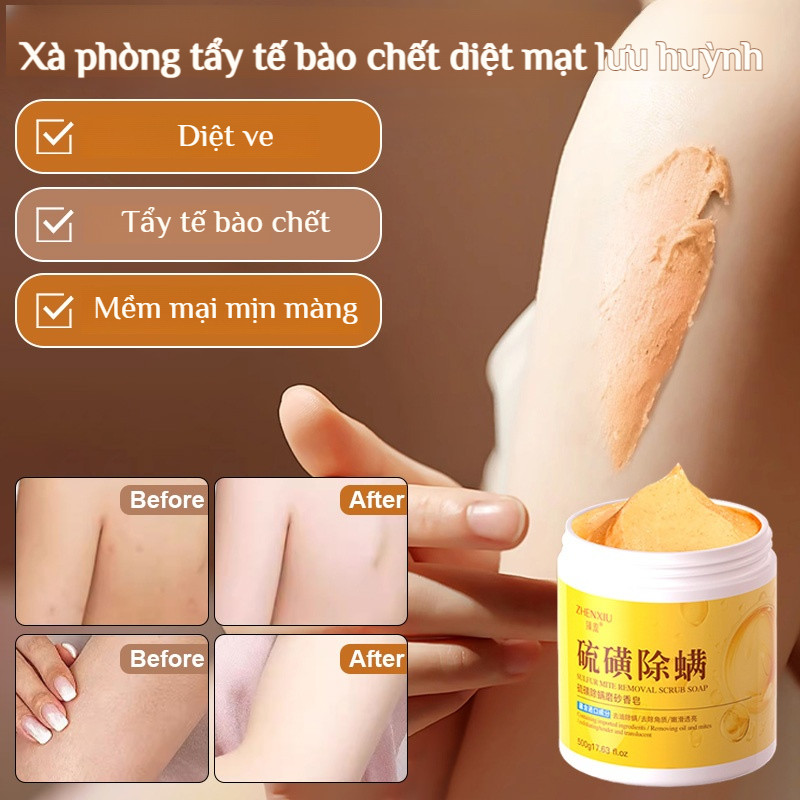 🛁Trừ Mạt Hiệu Quả/Tẩy Tế Bào Chết🌿Xà Phòng Lưu Huỳnh Diệt Khuẩn/Sữa Tắm Tẩy Da Chết Dịu Nhẹ/Sữa Tắ